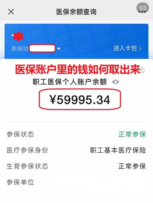 安泽医保在线提取新政策解读：你的医保余额真的能随时变现吗？